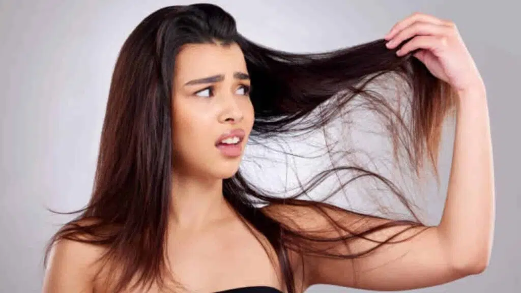 Oily Hair Problem | चिपचिपे बालों की समस्या